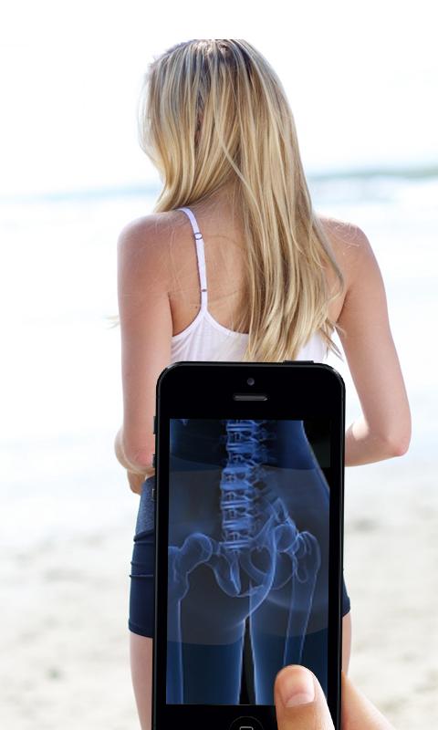 X-Ray Simulator : Prank