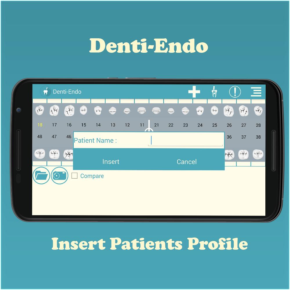 Denti-Endo