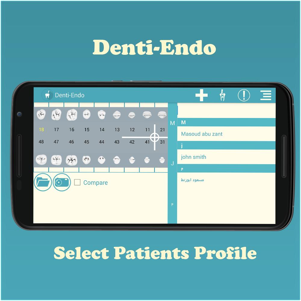 Denti-Endo