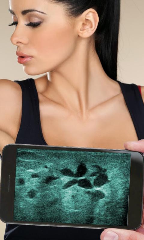 Ultra Sound Simulator : Prank